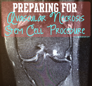 Avascular Necrosis Regenexx Stem Cell Procedure - It's Just A Bad Day