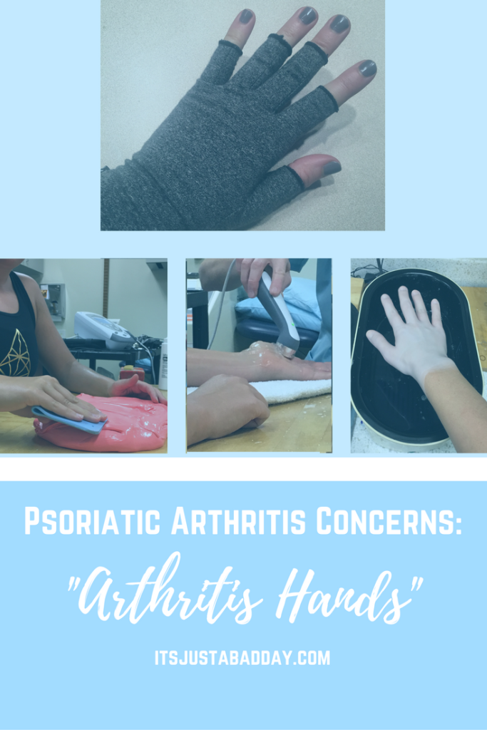 Psoriatic Arthritis Concerns: Arthritis Hands and Hand Deformiities with Autoimmune Arthritis | itsjustabadday.com 