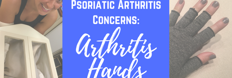 Psoriatic Arthritis / Rheumatoid Arthritis Concerns: Arthritis Hands | Dealing with hand pain, swelling, stiffness, tingliness, numbness with autoimmune arthritis. itsjustabadday.com