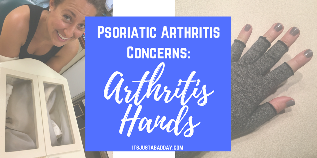 Psoriatic Arthritis / Rheumatoid Arthritis Concerns: Arthritis Hands | Dealing with hand pain, swelling, stiffness, tingliness, numbness with autoimmune arthritis. itsjustabadday.com