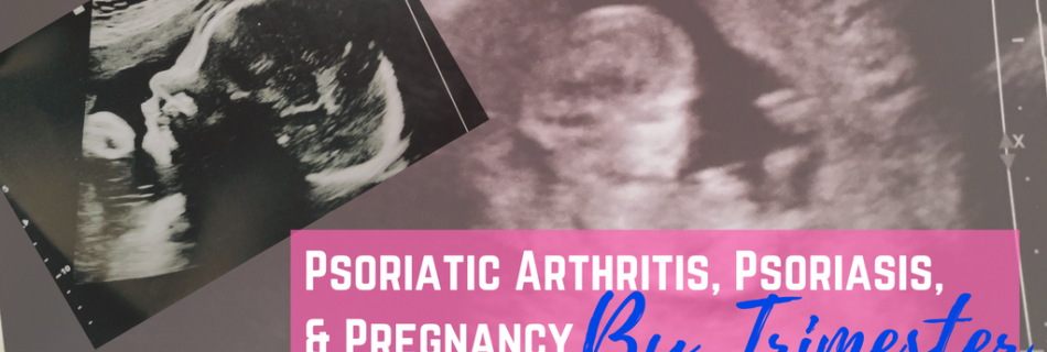 Psoriatic Arthritis, Psoriasis, & Pregnancy By Trimester_ itsjustabadday.com Rheumatoid Arthritis, Psoriatic Arthritis, Ankylosing Spondylitis